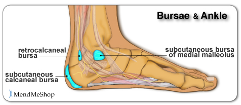 subcutaneous calcaneal bursa pain